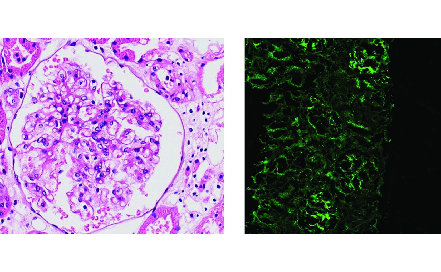 AI Tool Finds and Separates Kidney Parts in Fluorescent Images