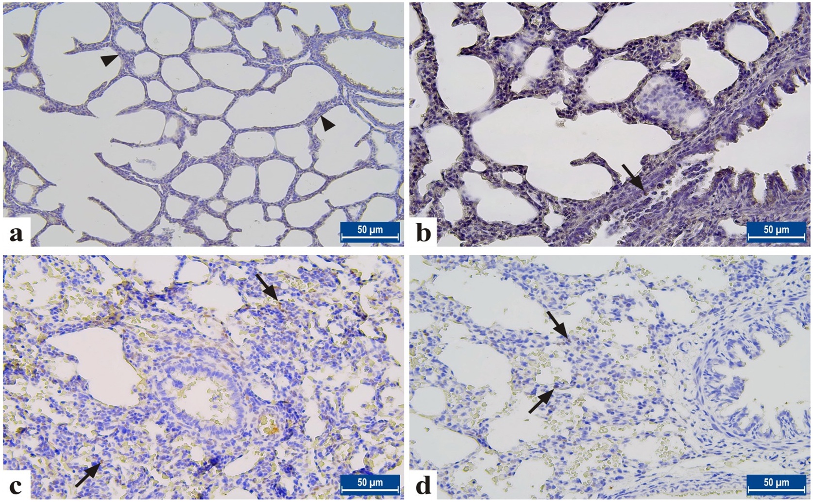 Olive Oil Helps Protect Lungs in Newborn Intestinal Disease: Effects on Proteins