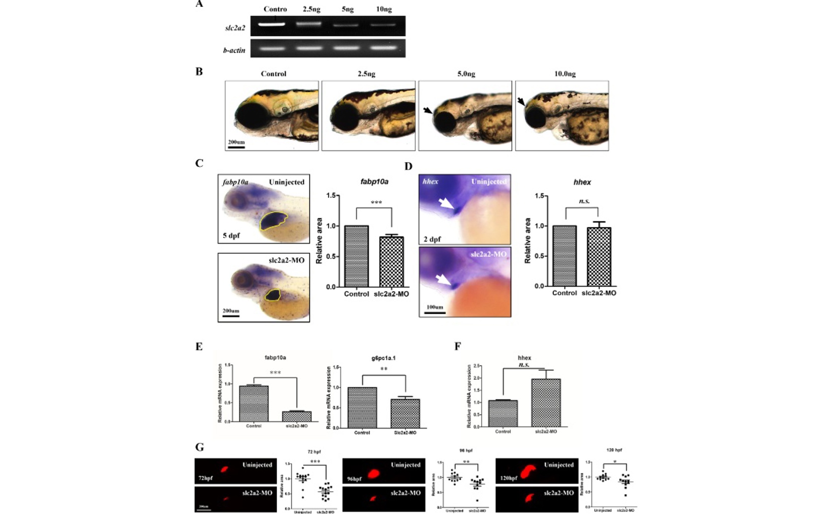 Glucose Transporter 2: A Key Player in Liver Cell and Liver Cancer Development