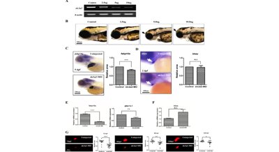 Glucose Transporter 2: A Key Player in Liver Cell and Liver Cancer Development