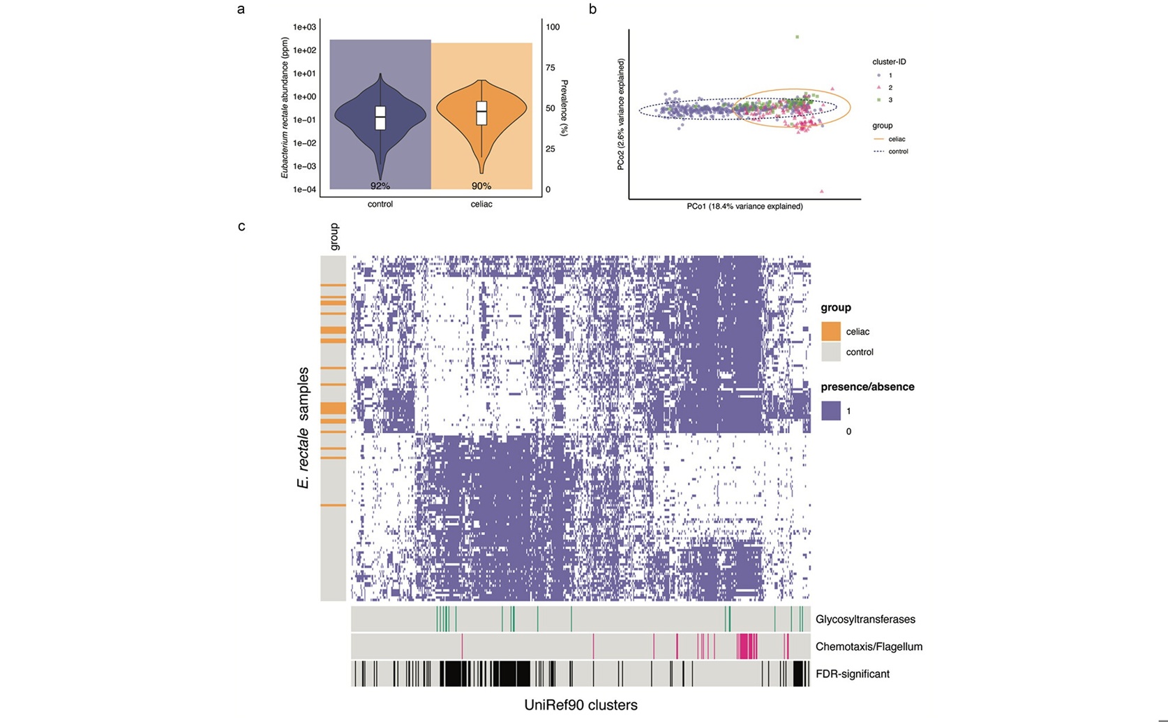 Detailed Study of Treated Celiac Disease Gut Bacteria Shows Varied Types