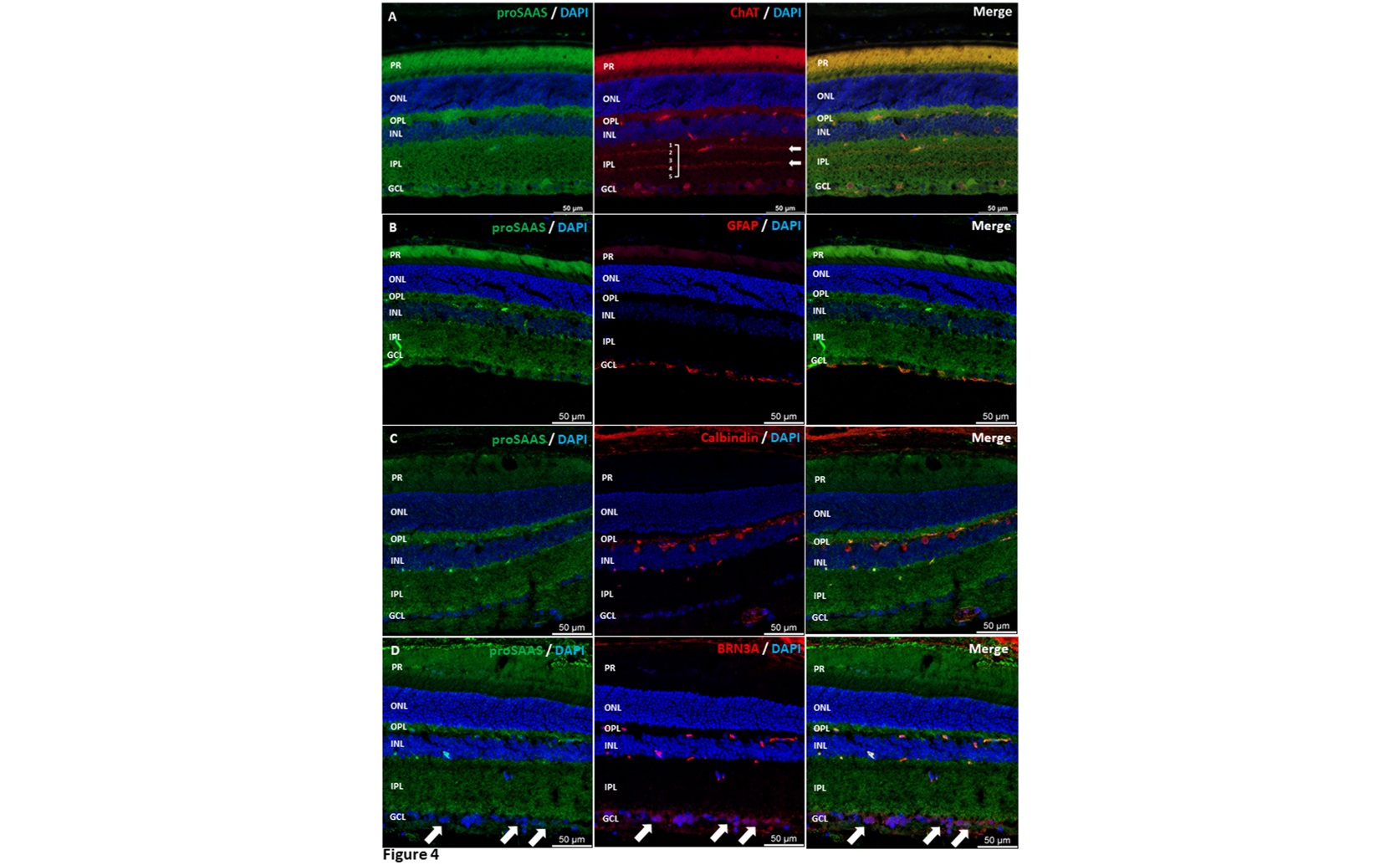 Protein Helper proSAAS is Abundant in the Eye's Retina