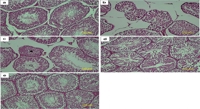 Garlic and Bitter Apple's Impact on Male Fertility in Diabetes
