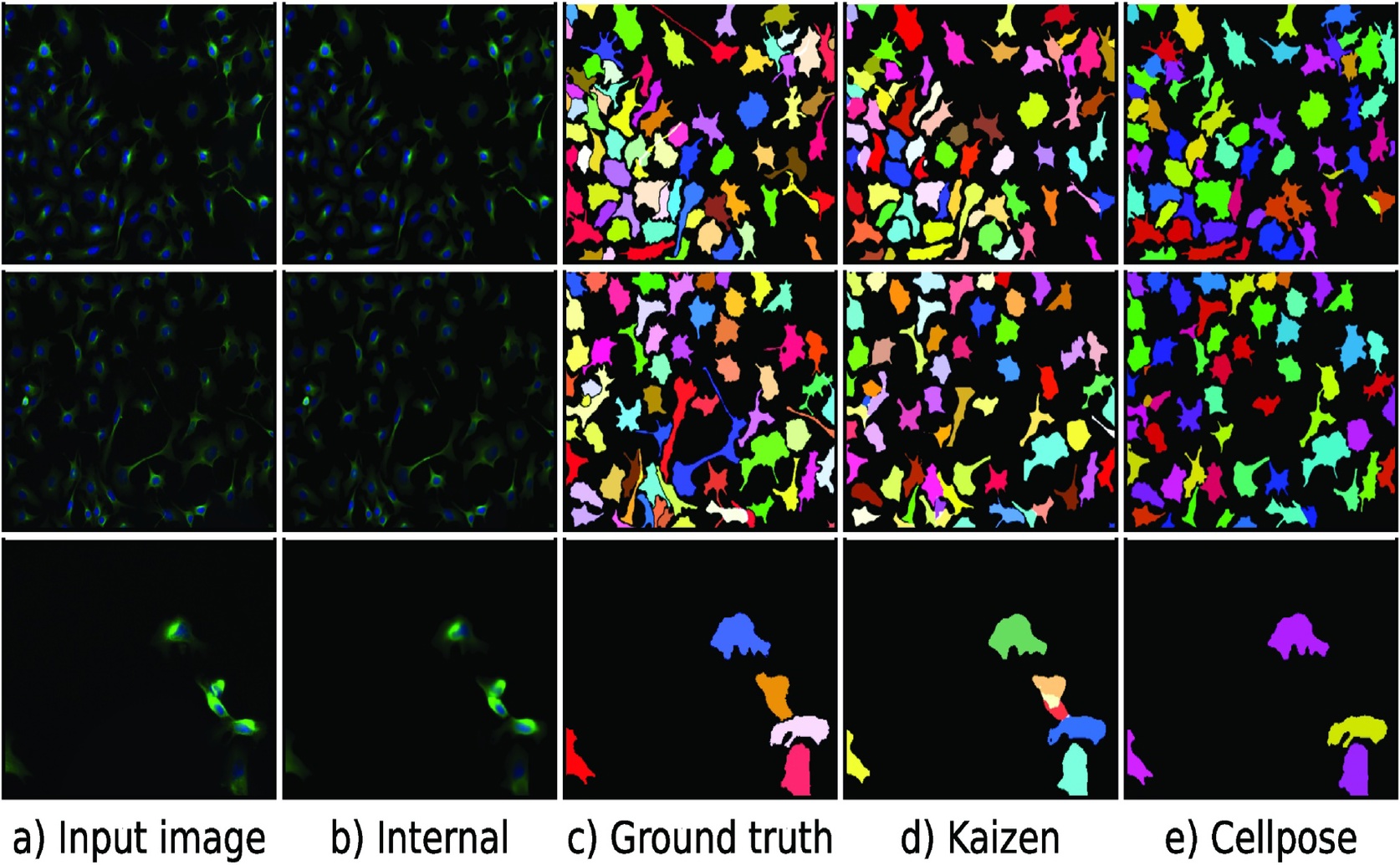 Kaizen: Breaking Down Cell Images With an AI Technique