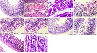 Nanoparticle Therapy With Black Seed Compound Reduces Parasite Damage