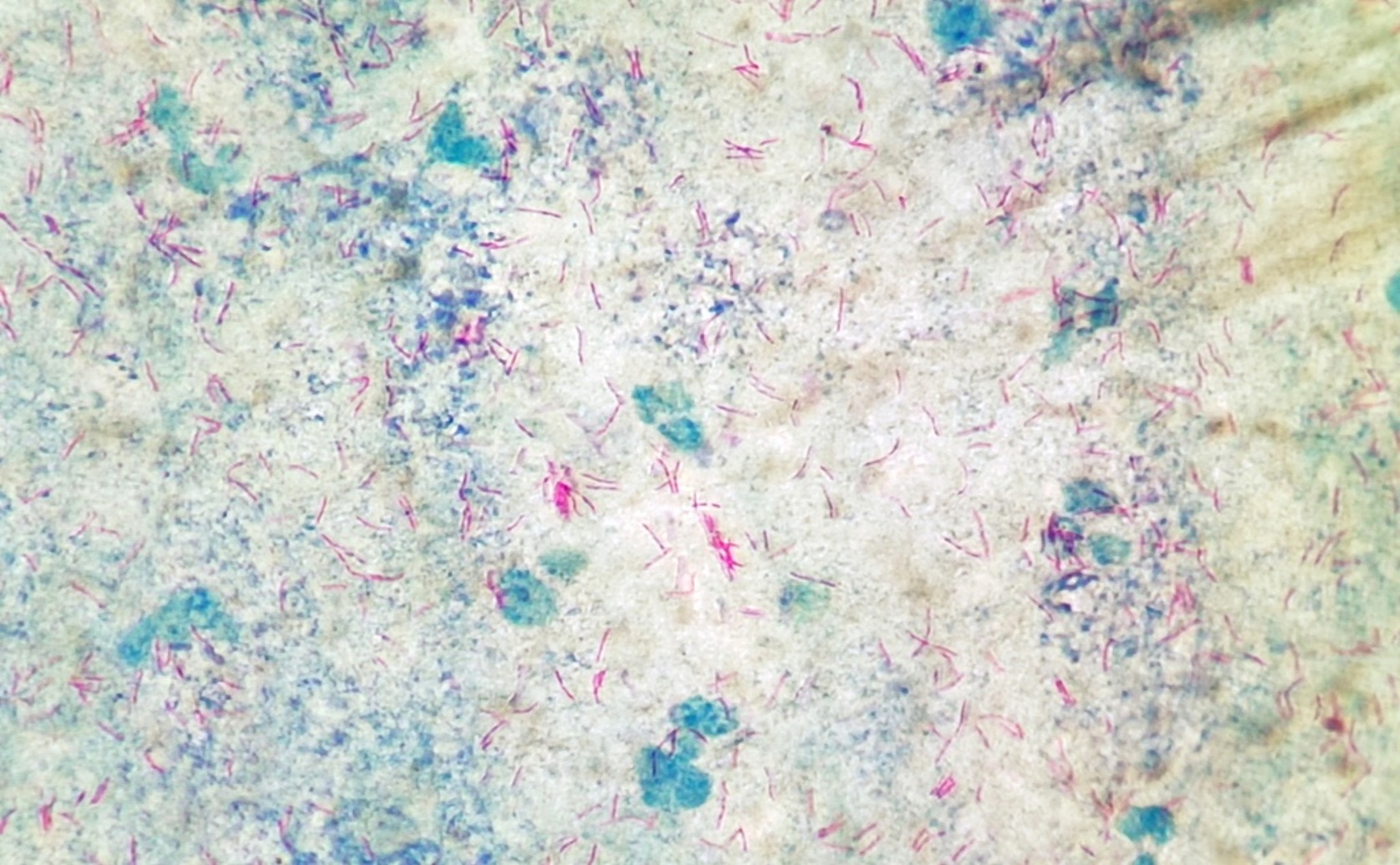 Iron-Starved TB Bacteria Secrete Disease Factors in Little Packages