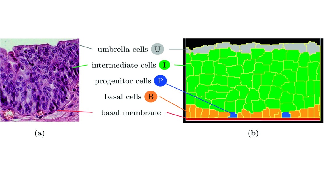 Bladder Lining Repair: A Computer Model Of Cell Growth And Change