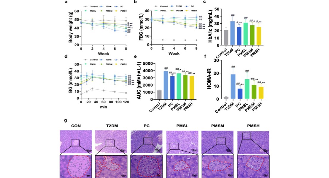 Natural Compound Shields Pancreas Cells, Aiding Type 2 Diabetes