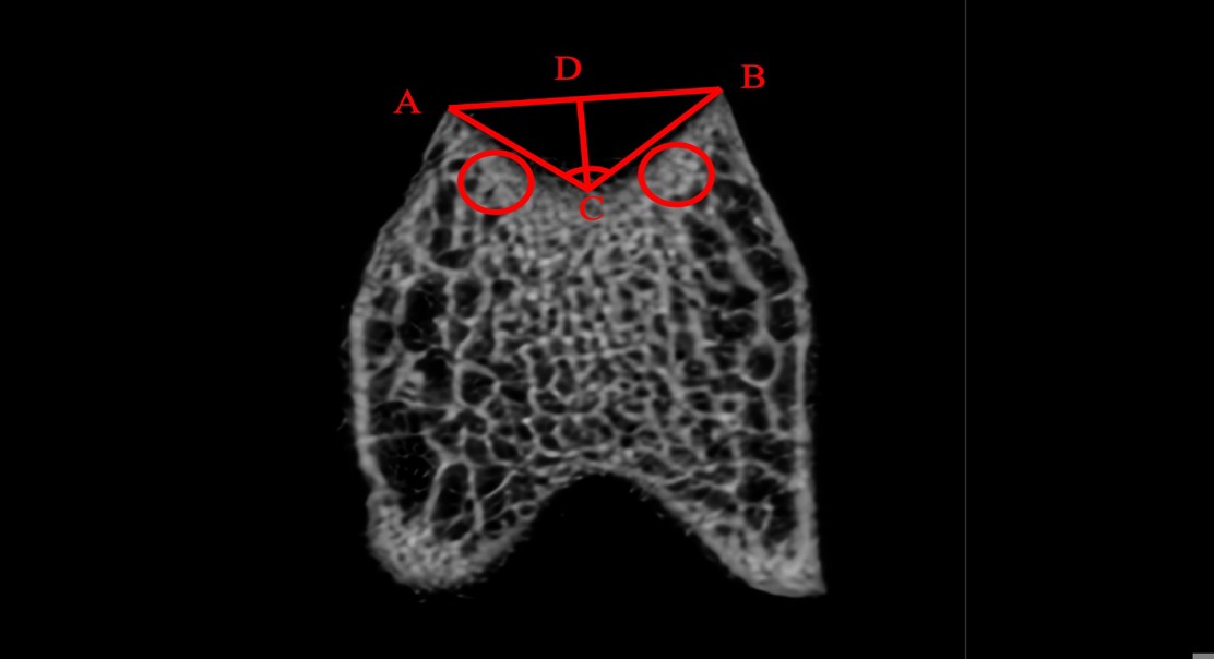 Unlocking Body Chemistry for Kneecap Issues