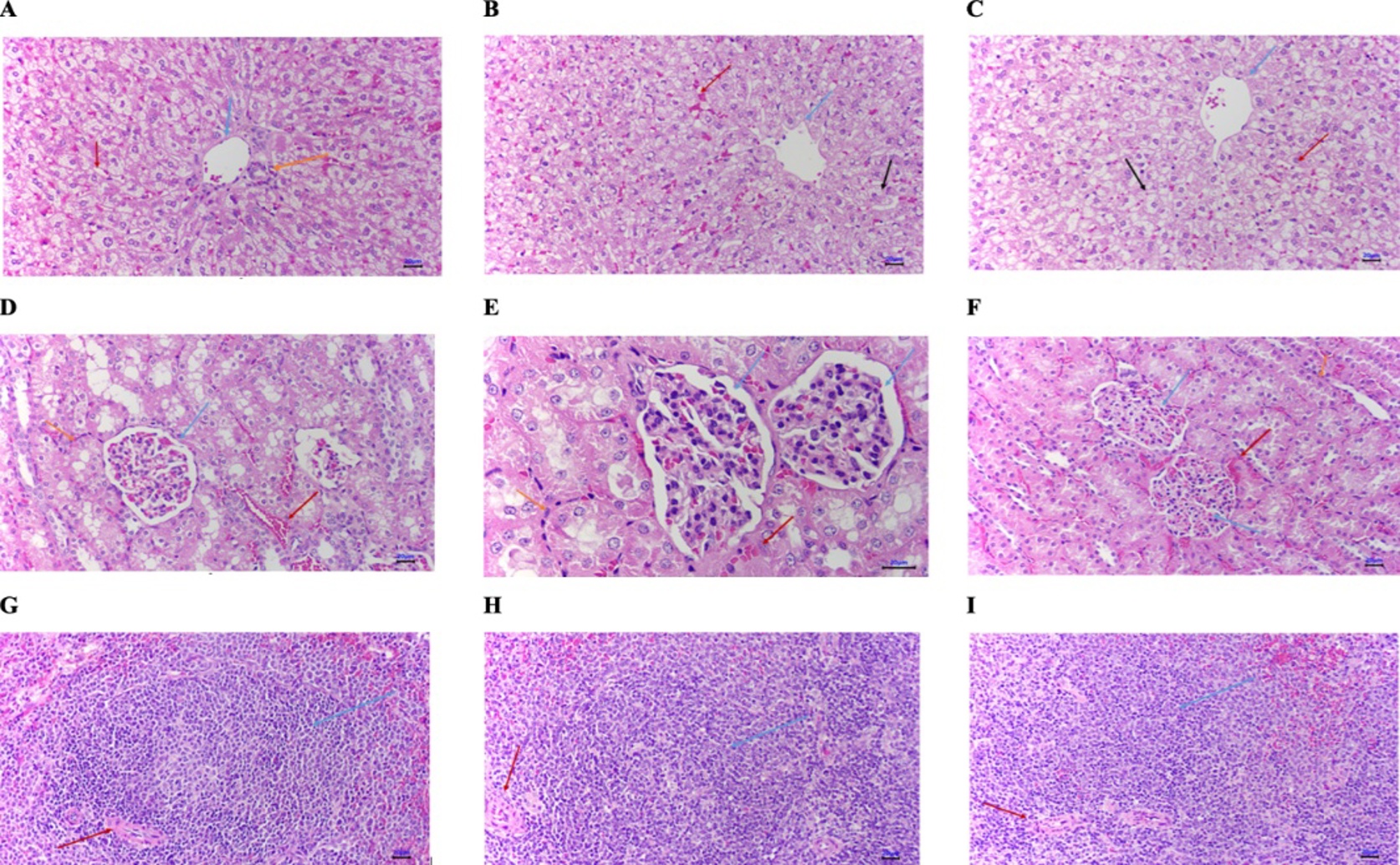 New Compounds Fight Skin Infections With Both Antifungal And Antibacterial Power