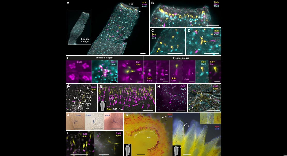Genetic Links in Skeleton Formation of Sponges and Stony Corals