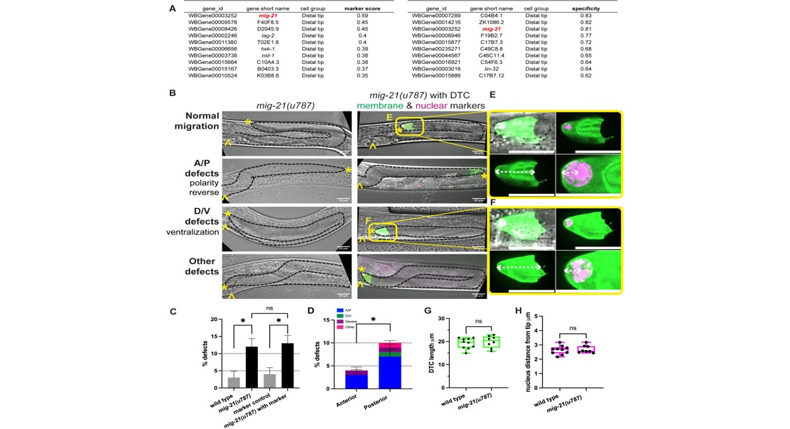 How MIG-21 Affects Gonad Movement Through Wnt and Netrin Pathways