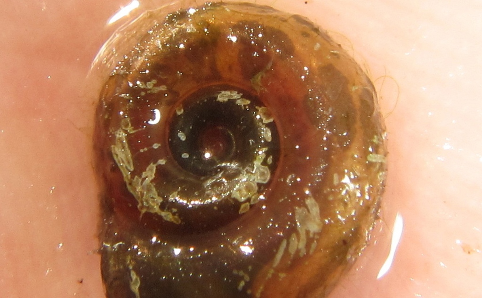 How Surroundings Affect Snail Numbers and Where They Live