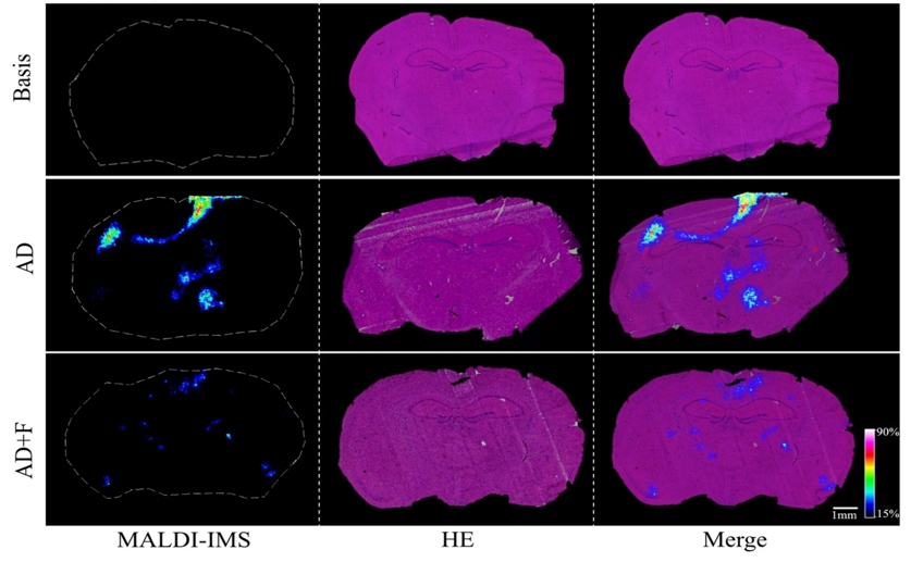 Dietary fiber could help protect the brain from Alzheimer's disease