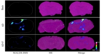 Dietary fiber could help protect the brain from Alzheimer's disease