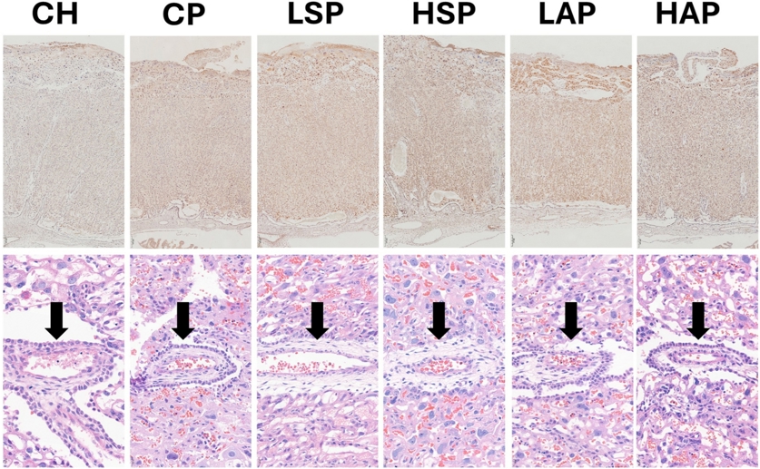 Aspirin shows complex, dose-dependent effects on placental health in new preeclampsia study