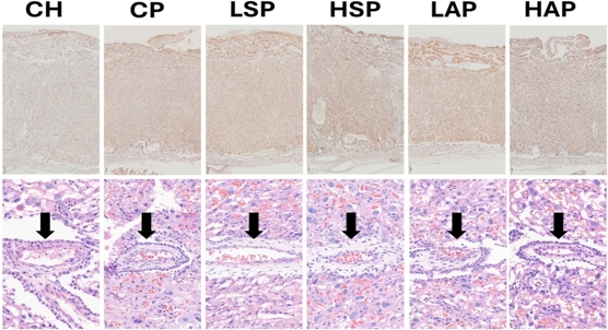 Aspirin shows complex, dose-dependent effects on placental health in new preeclampsia study