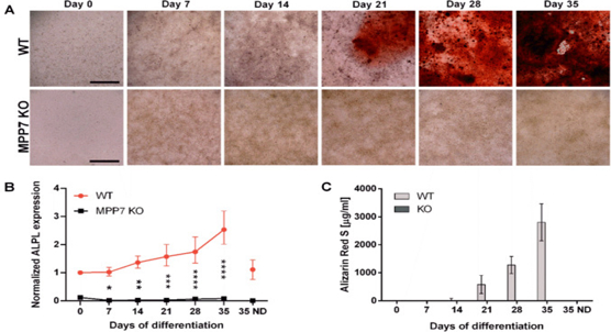Protein crucial for bone growth linked to osteoporosis risk