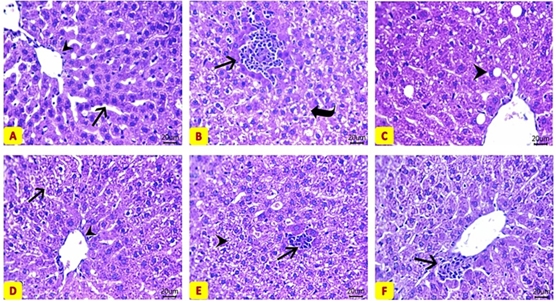 Olive oil and exosomes show promise in treating fatty liver disease