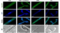 How plant defenses can disable fungal infection pathways