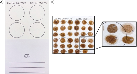 Simple DNA tests can quickly detect diseases in honey bees