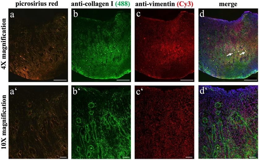 Horse scar tissue composition reveals clues about healing speed