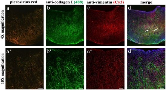 Horse scar tissue composition reveals clues about healing speed