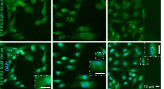 Cellular cleanup process ramps up under stress, study finds