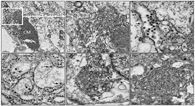 Hidden threat: New insights into the Bussuquara virus and its impact
