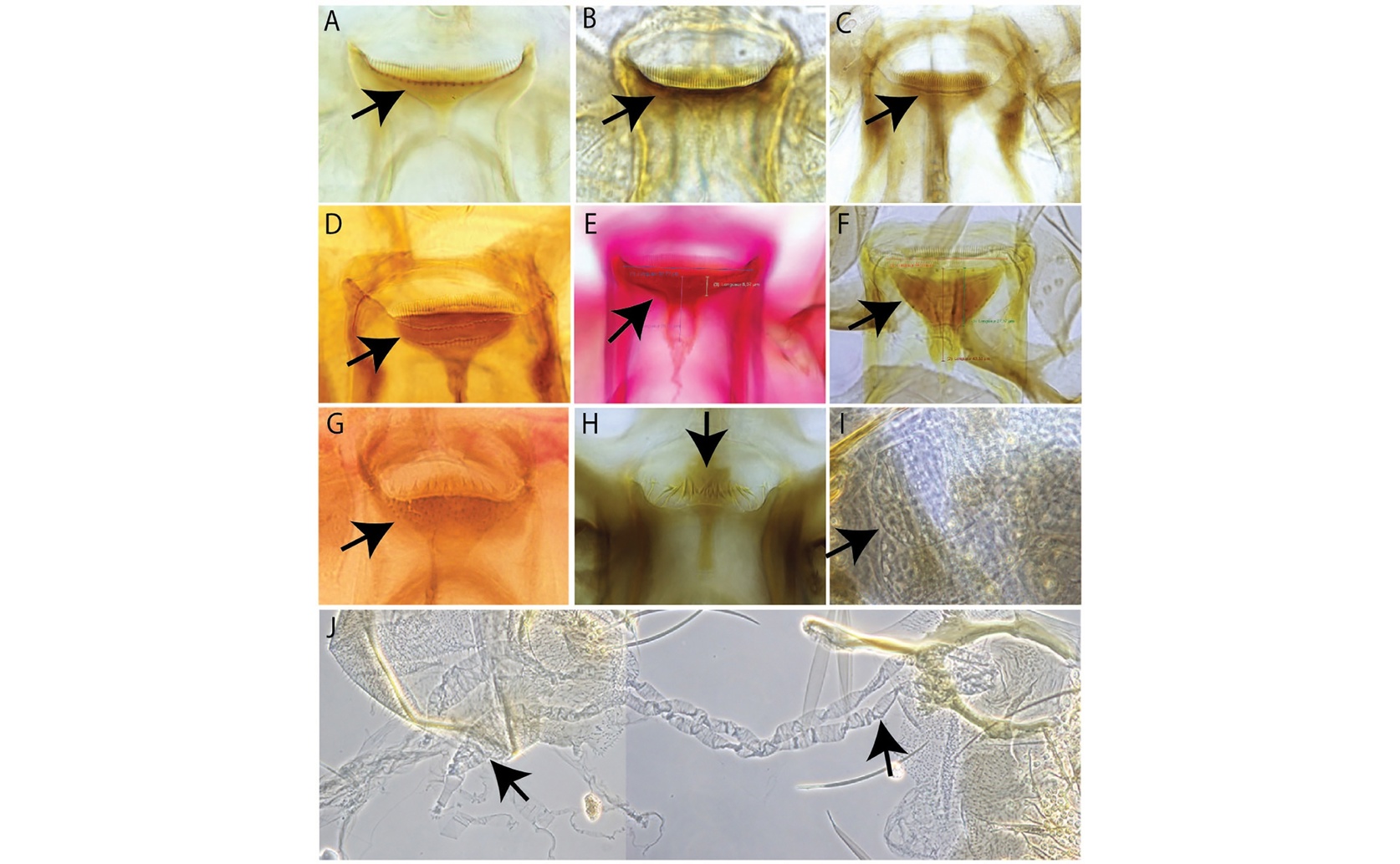 Sandflies in Laos reveal new species and disease risks