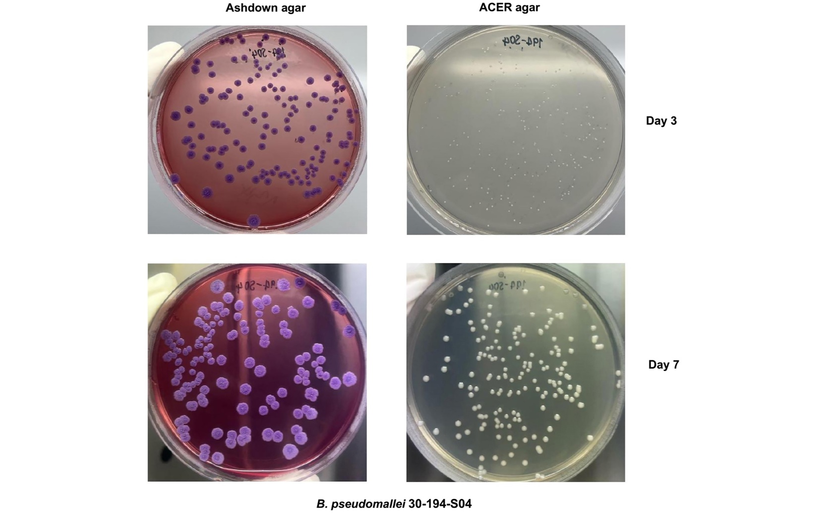 New tests improve detection of melioidosis bacteria in soil