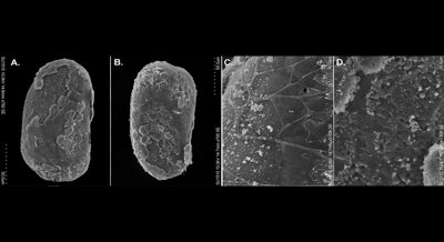 Surface Patterns of Sand Fly Eggs from Different Species