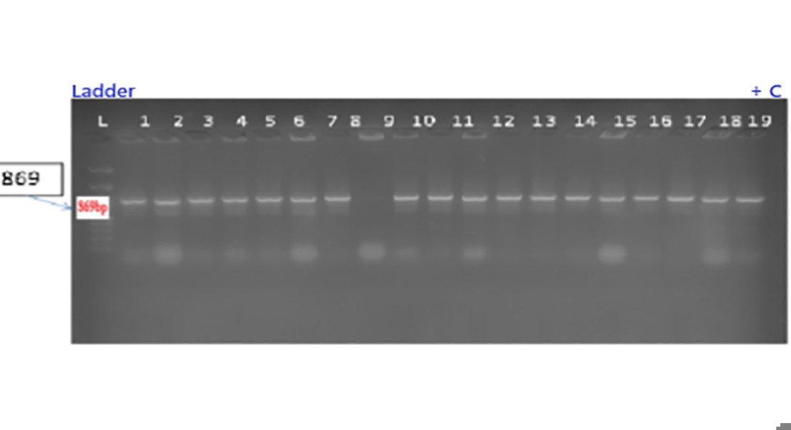 Gene editing improves soybean oil quality