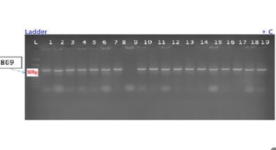 Gene editing improves soybean oil quality