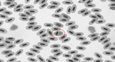 Gut bacteria differences linked to malaria infection risk in wild birds