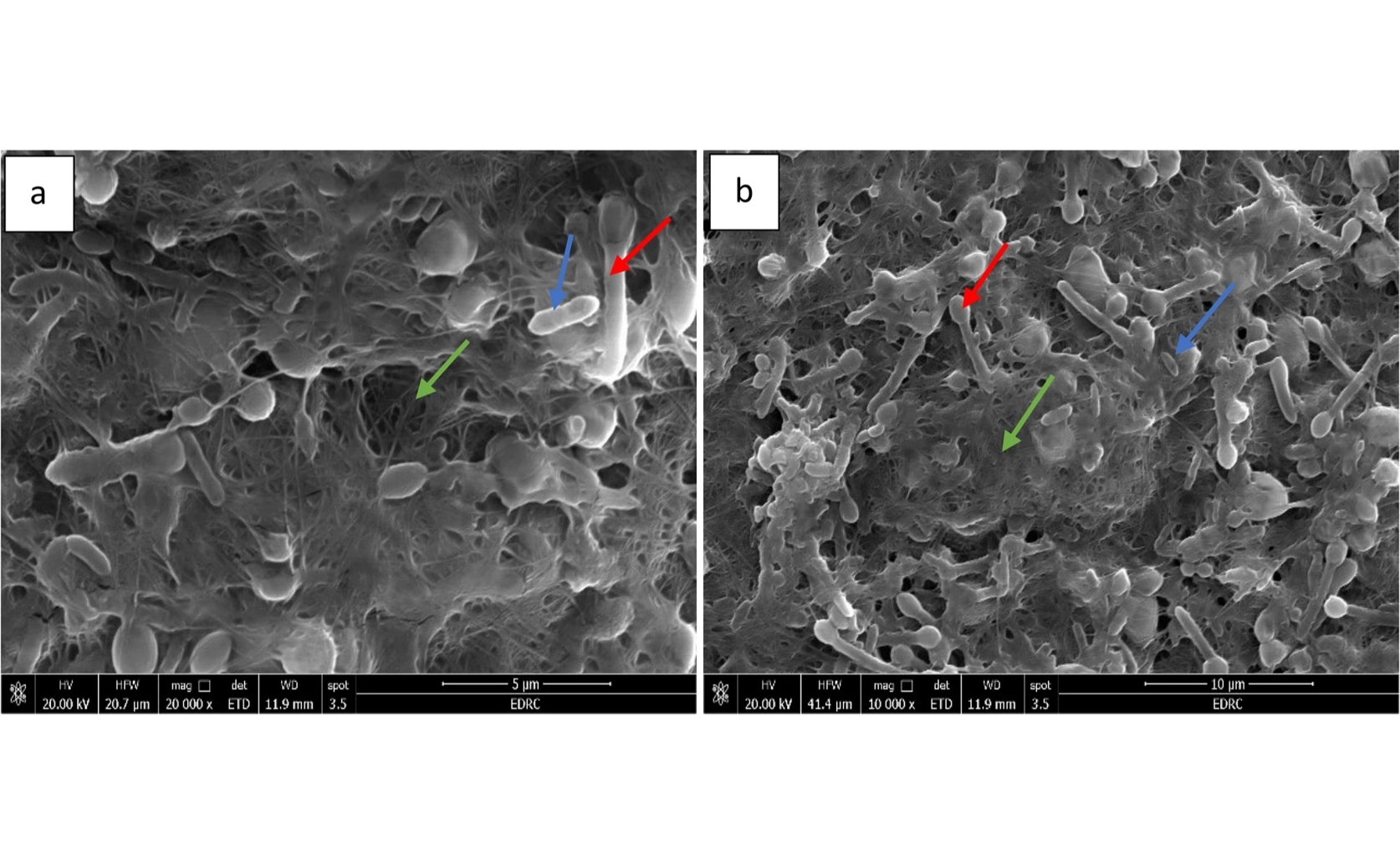 Boosting onion growth and soil health with beneficial microbes
