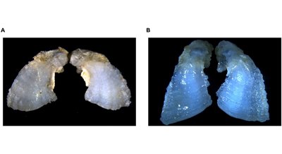 Ear bones and fins reveal distinct Atlantic sturgeon populations