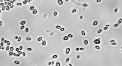 New Low Temperature System for Enhanced Gene Expression in Yeast