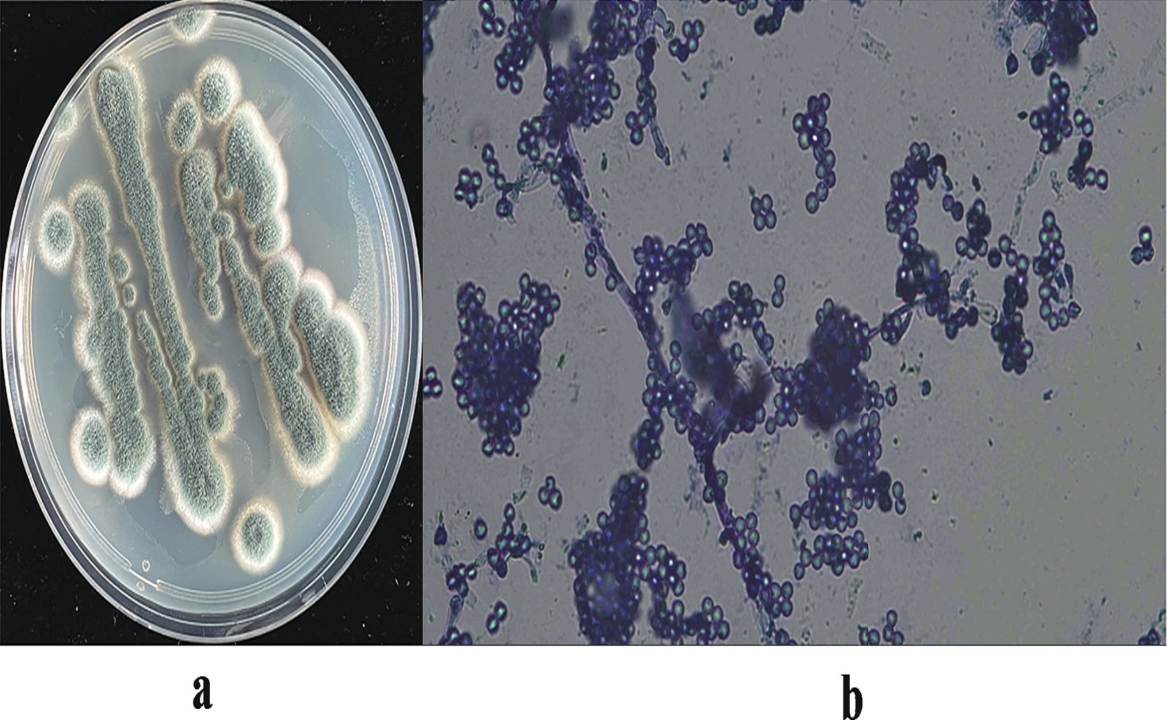 Discovering the Hidden Potential of an Arctic Marine Fungus for Medicine
