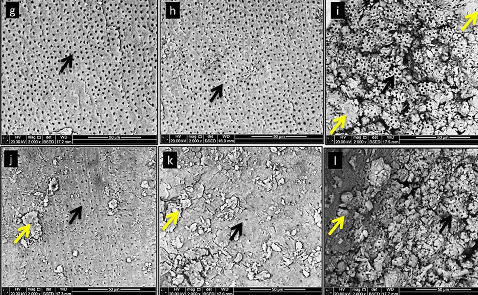 How Herbal Solutions Affect Tooth Root Surface Using 3D Texture Analysis