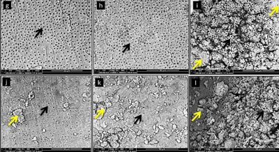 How Herbal Solutions Affect Tooth Root Surface Using 3D Texture Analysis