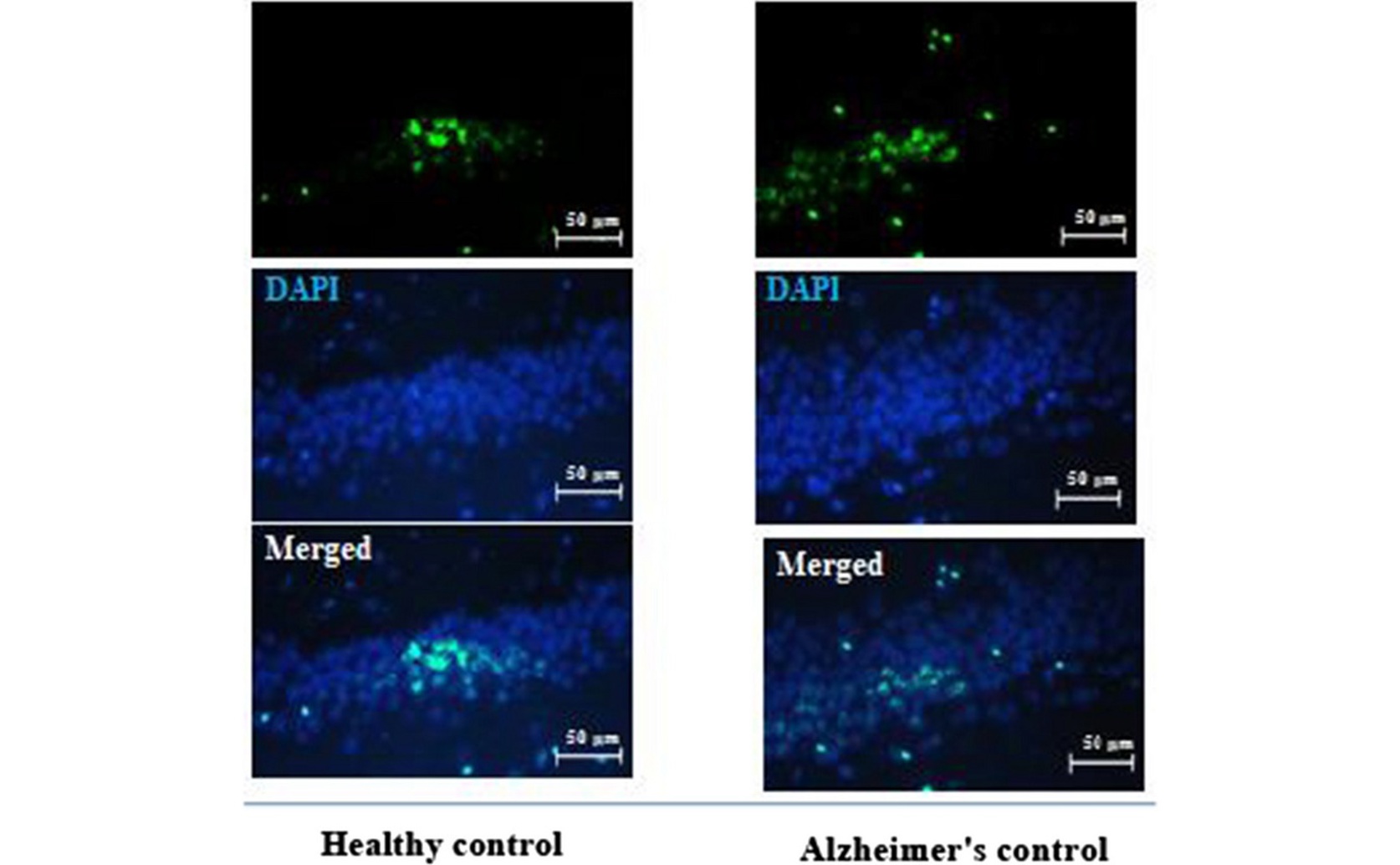 How Exercise and Hawthorn Affect Pain Thresholds in Alzheimer's Research