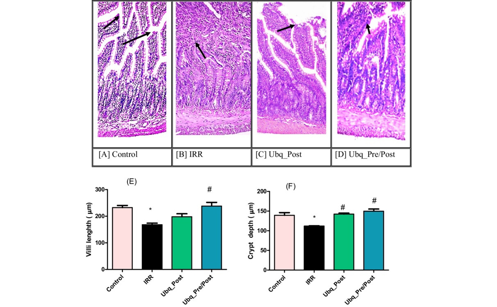 Healing and Gut Health Benefits of Ubiquinol in Radiation-Damaged Intestines