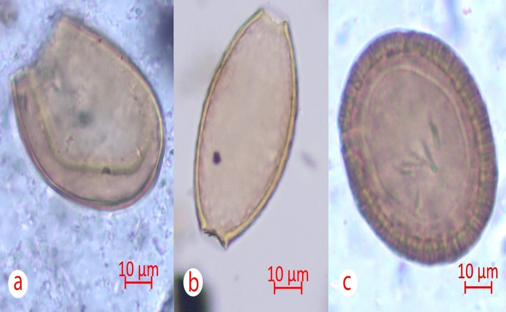 Parasites Reveal Fish in Diet of Iron Age Herding Communities