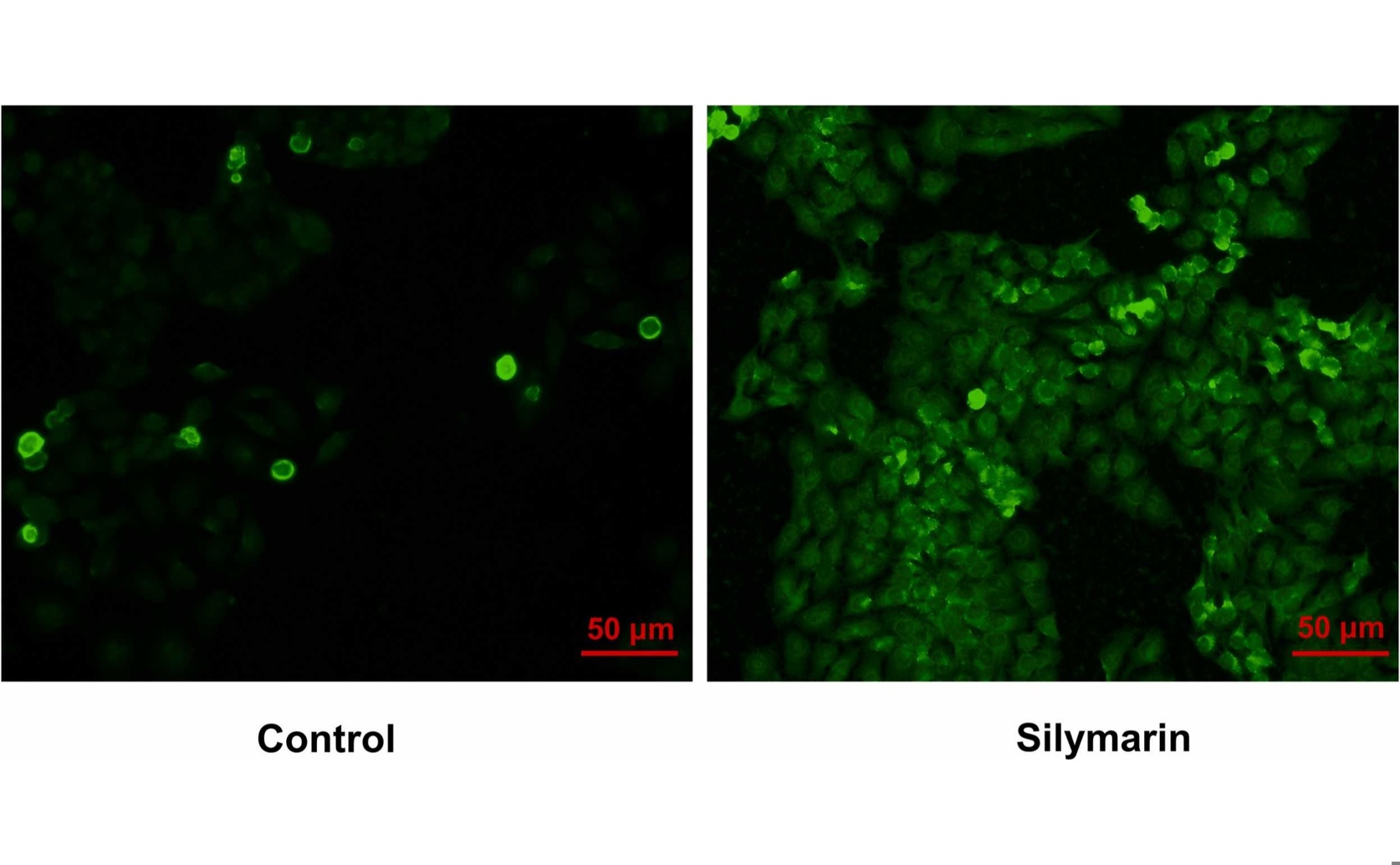 How Silymarin Fights Lung Cancer and Stops Its Spread