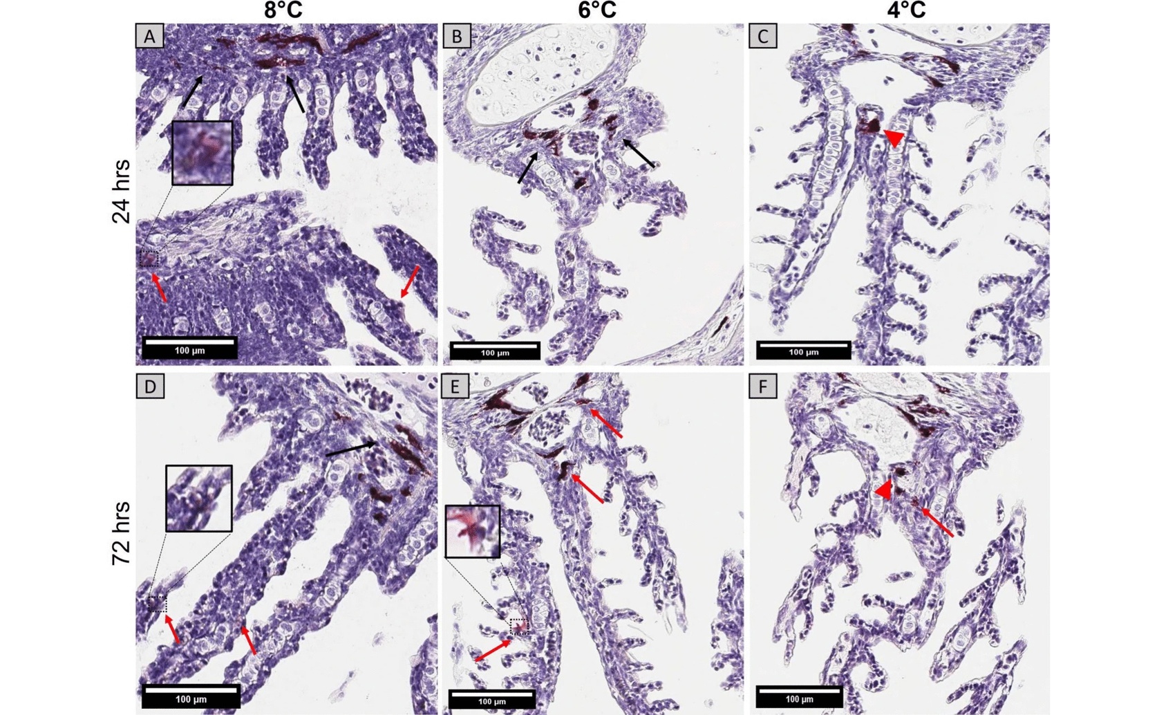 How Embryo Temperature Affects Young Salmon's Response to Bacterial Infections