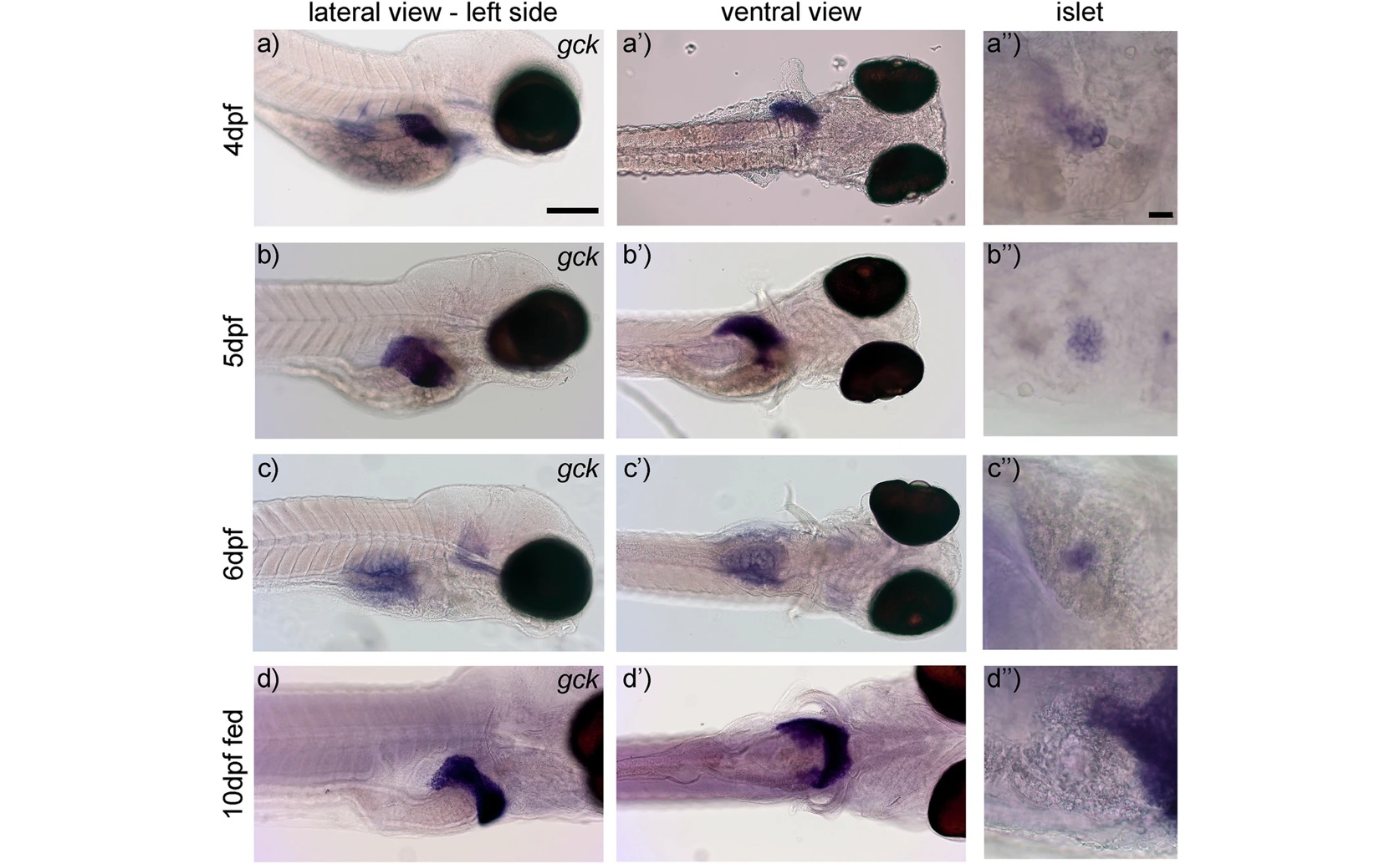 Glucokinase Regulation Confirms Potential for Diabetes Treatment