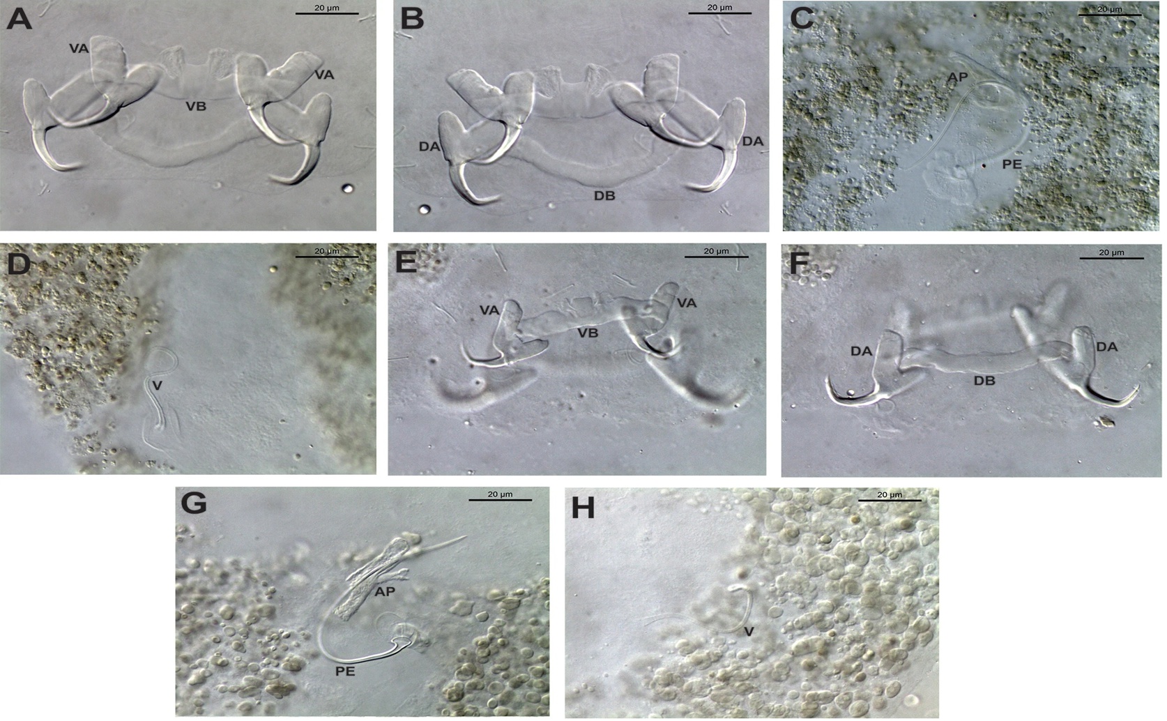 Detailed Study of Two Parasite Species in Mullets and Their Geographic Spread