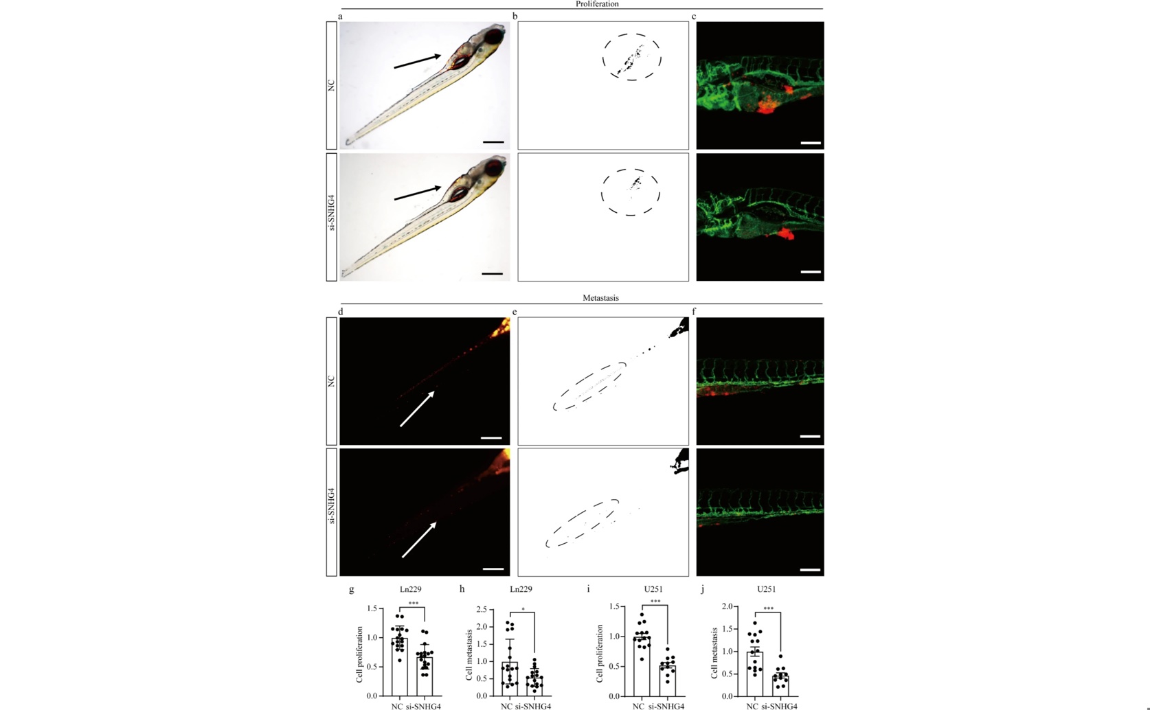 SNHG4 RNA Boosts Brain Tumor Growth by Controlling Key Molecules