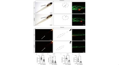 SNHG4 RNA Boosts Brain Tumor Growth by Controlling Key Molecules